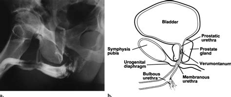 urethra injury test results